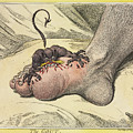 The Gout 1799 by James Gillray t1
